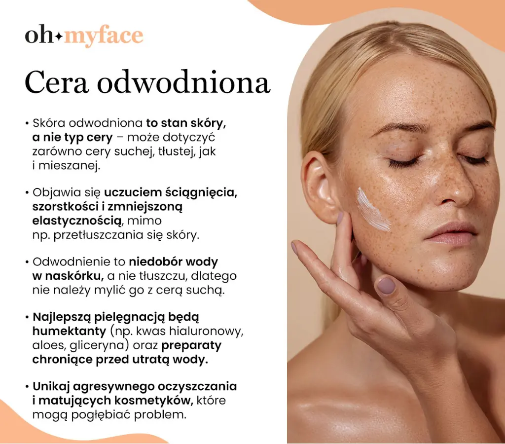 Infografika o cechach cery odwodnionej