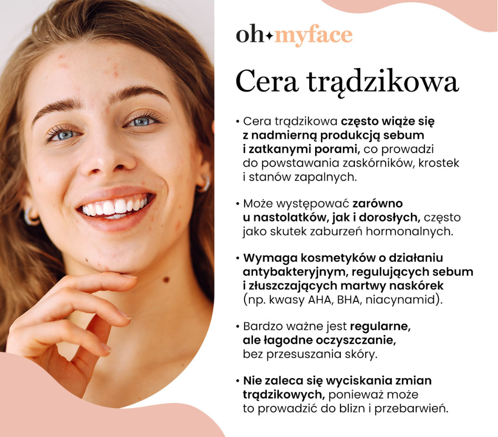 Infografika o cechach cery trądzikowej