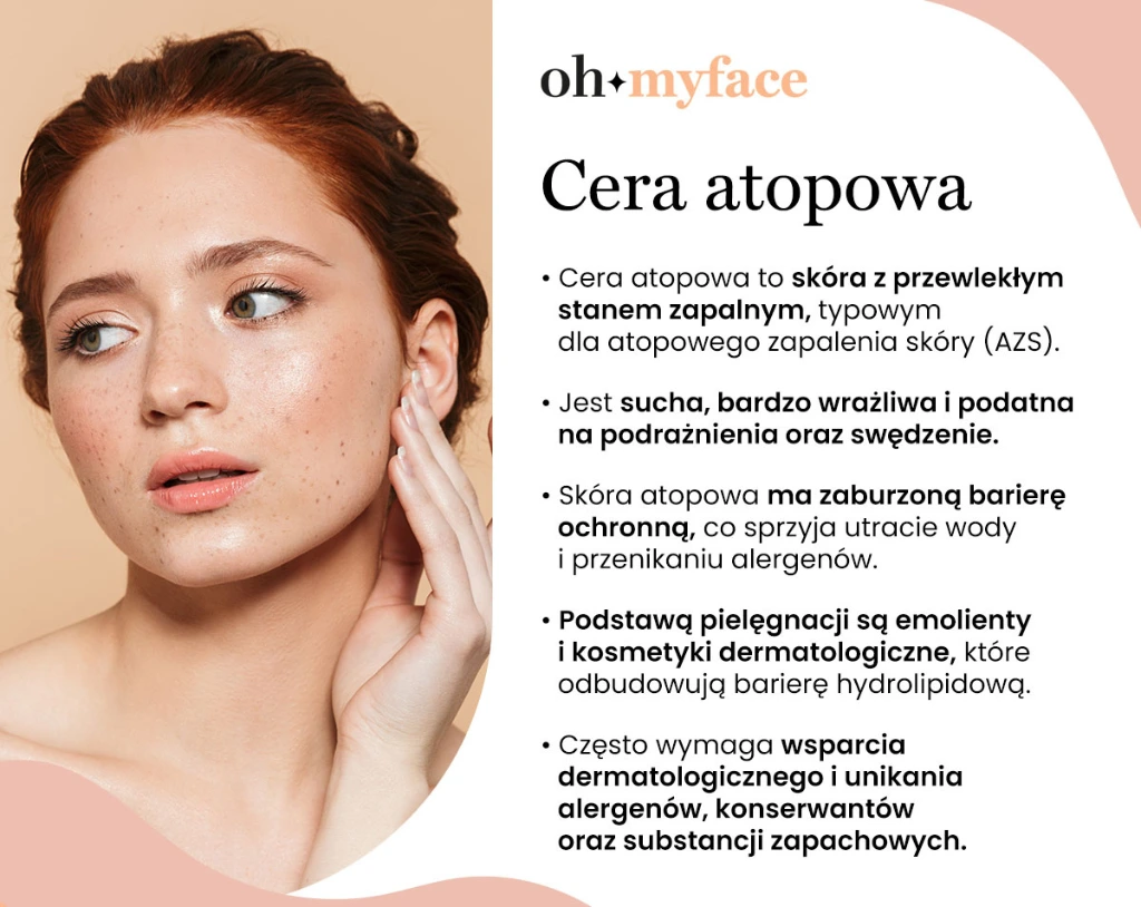 Infografika Oh My Face o cerze atopowej 