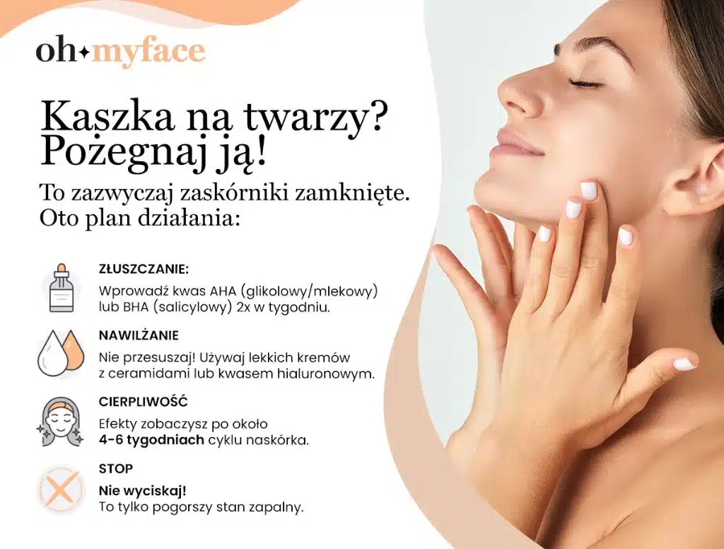 Infografika Oh My Face na temat kaszki na twarzy i pielęgnacji cery 