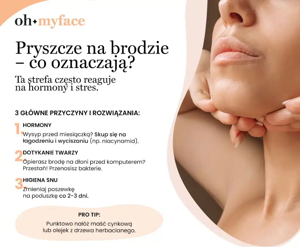 Infografika Oh My Face na temat pryszczy na brodzie 